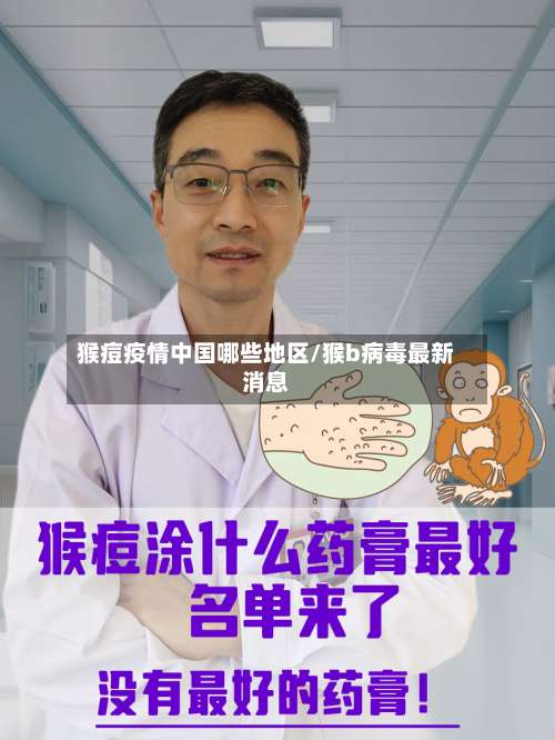 猴痘疫情中国哪些地区/猴b病毒最新消息-第2张图片